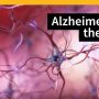 Caring for Seniors with Dementia