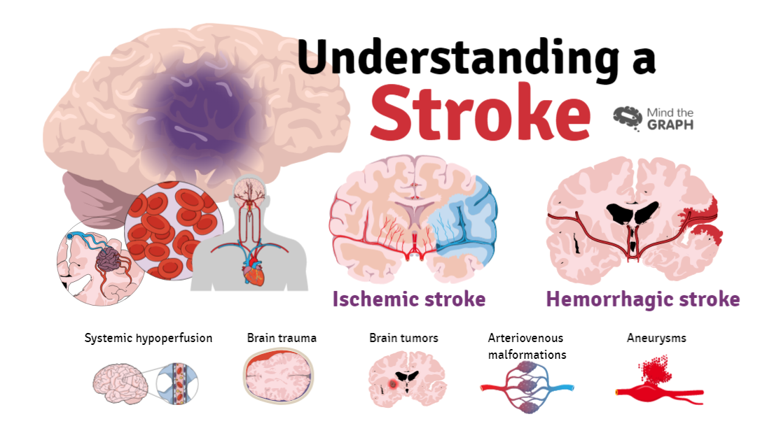 Recognizing the Signs of a Stroke