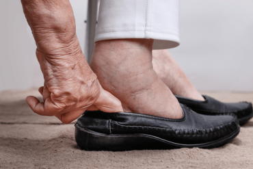 The Dangers Of Fluid Retention In Seniors