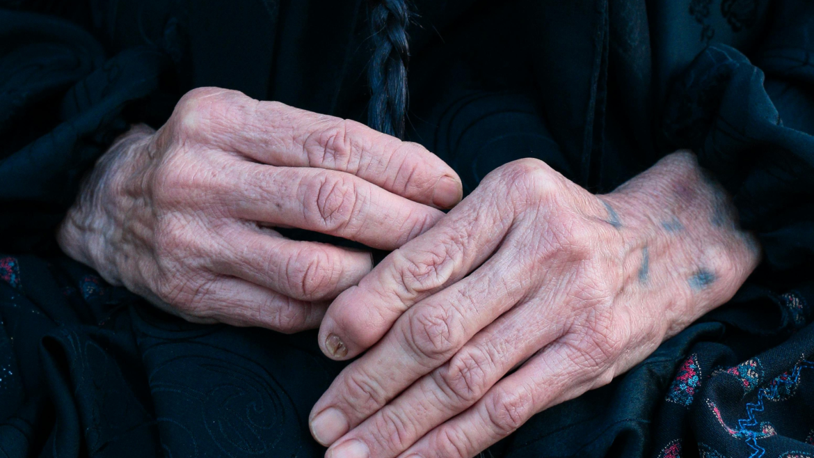 Why Do Seniors Bruise So Easily?