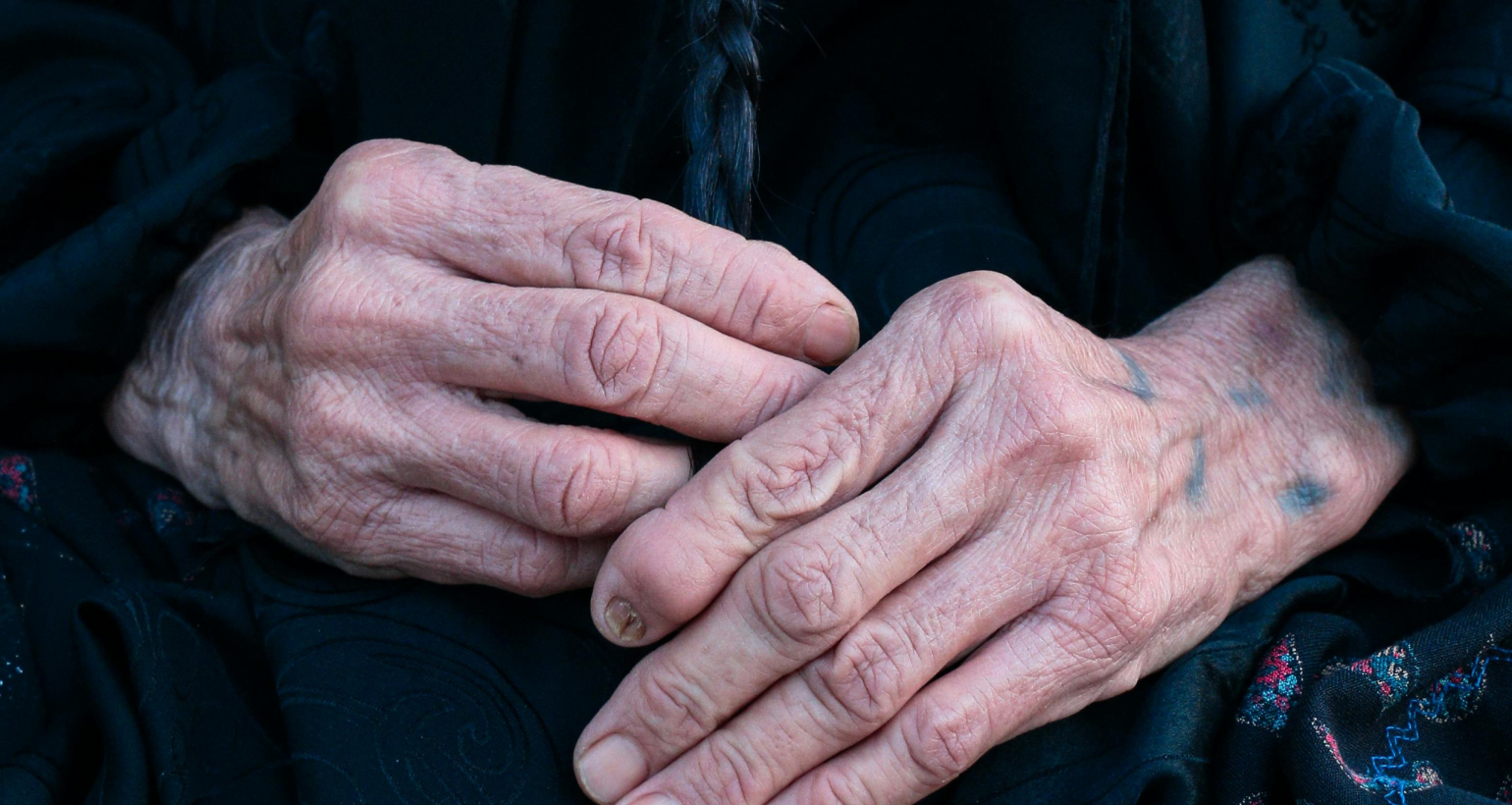 Why Do Seniors Bruise So Easily?